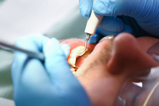 Best Urgent Dental Care for Toothache in St Hedwig, TX