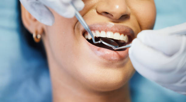 Best Emergency Dental Services for Seniors in St Hedwig, TX